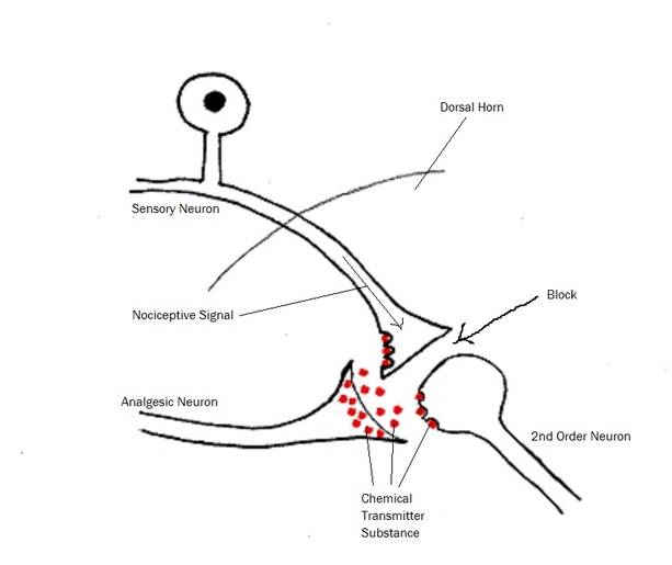 Descending Inhibition - HeadWorks Physiotherapy